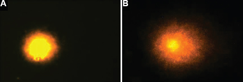 Comet assay of blood cells: (A) intact and (B) fragmented comet tail DNA.